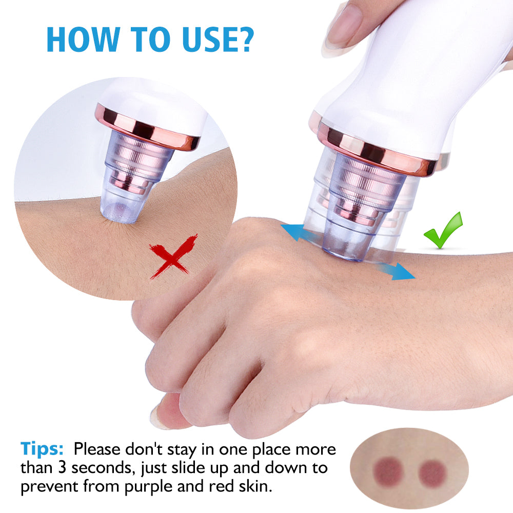 Poreva™ Pore Vacuum & Blackhead Extractor