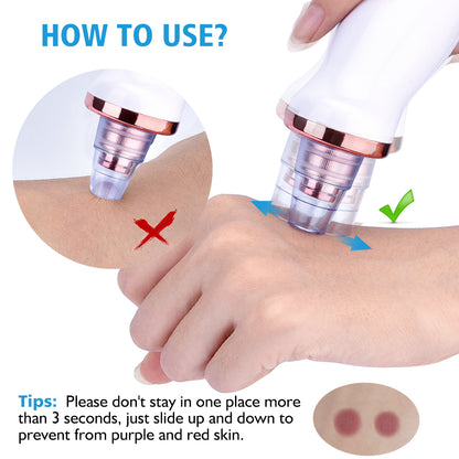Poreva™ Pore Vacuum & Blackhead Extractor