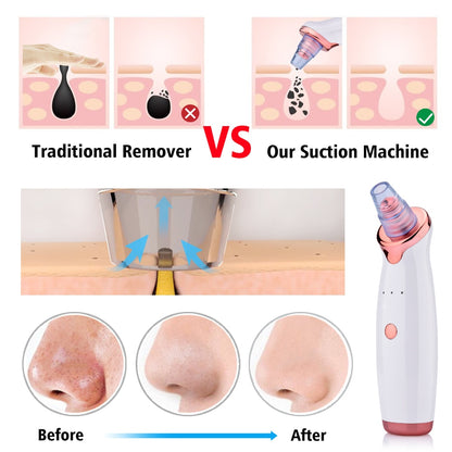 Poreva™ Pore Vacuum & Blackhead Extractor